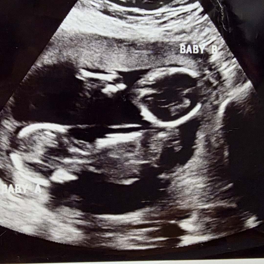 Photo shared by Adrienne for their Babylist baby registry.