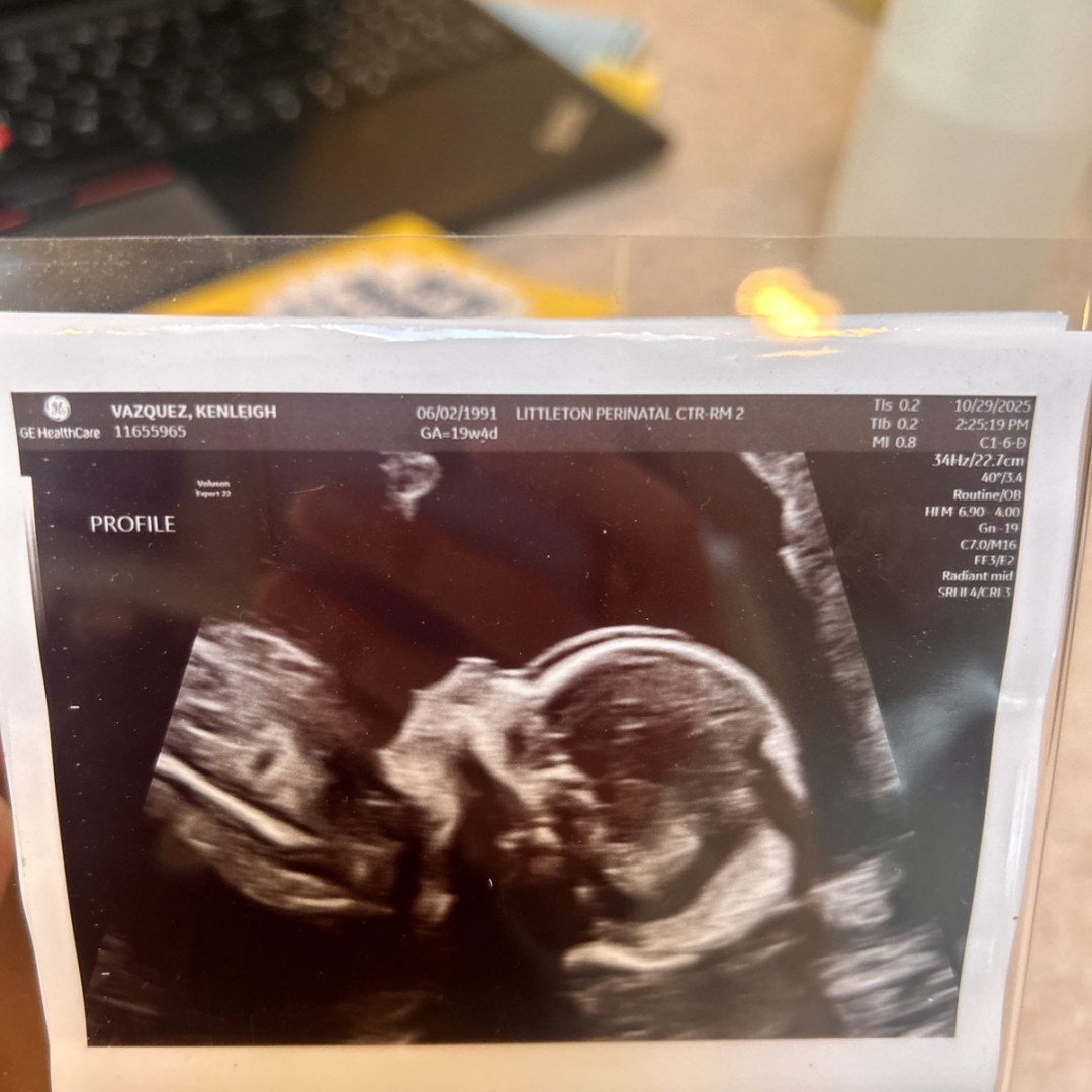 Photo shared by Kenleigh for their Babylist baby registry.