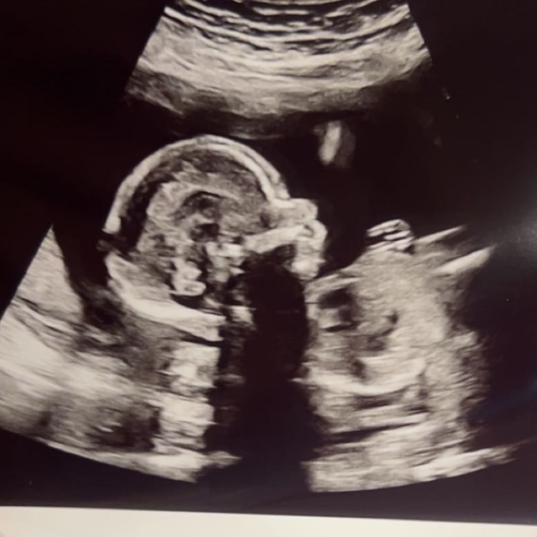 Photo shared by Ally for their Babylist baby registry.