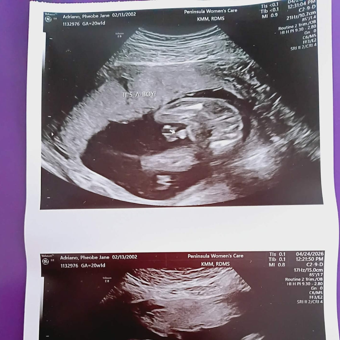 Photo shared by Pheobe Jane for their Babylist baby registry.