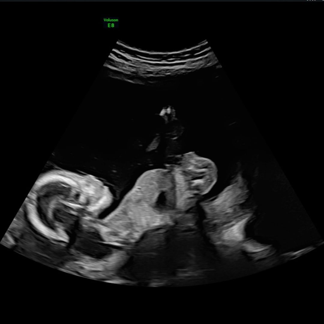 Photo shared by Kala for their Babylist baby registry.