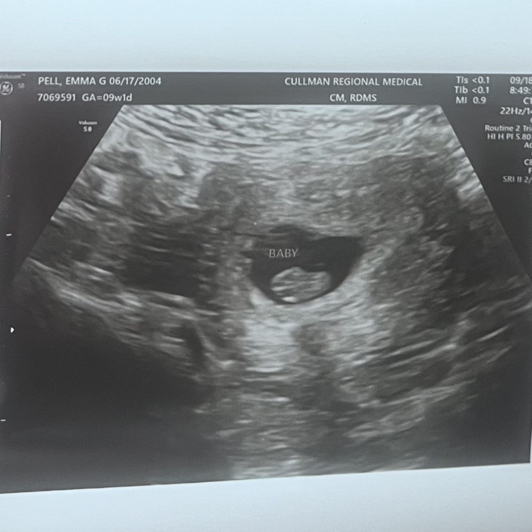 Photo shared by Emma for their Babylist baby registry.