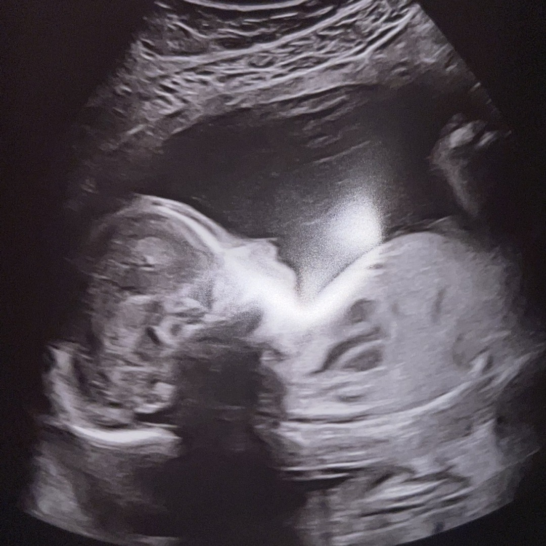 Photo shared by Chloe for their Babylist baby registry.