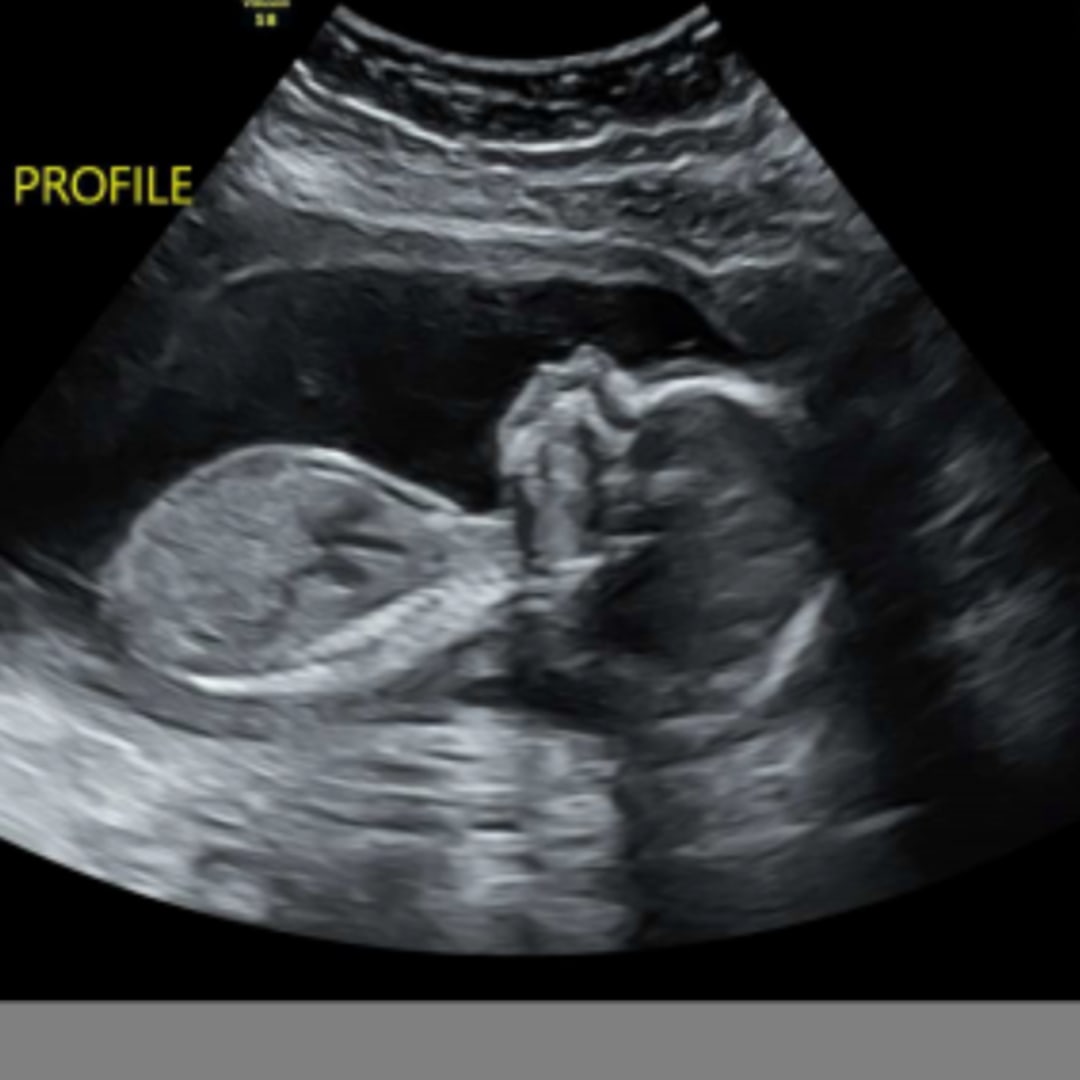 Photo shared by Haley for their Babylist baby registry.