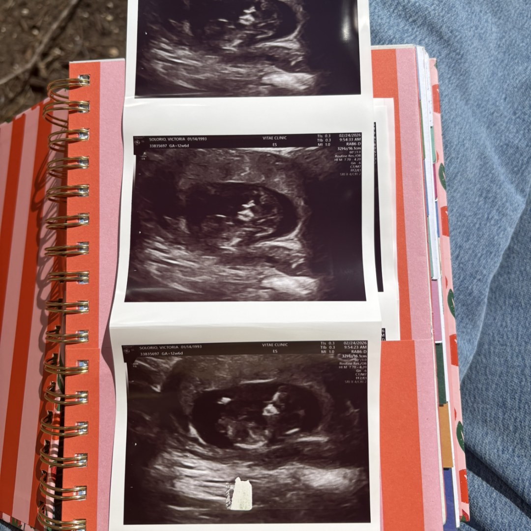 Photo shared by Victoria for their Babylist baby registry.