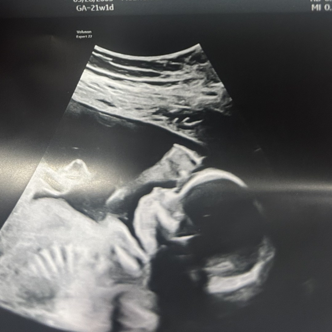 Photo shared by Kiana for their Babylist baby registry.