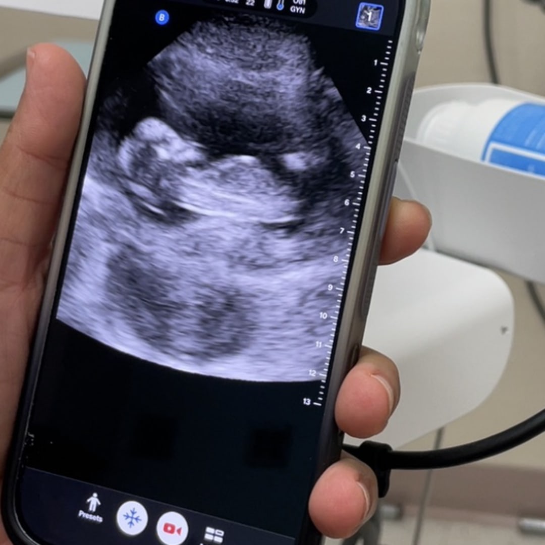 Photo shared by Summar for their Babylist baby registry.