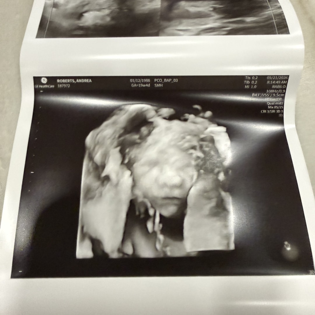 Photo shared by Andrea for their Babylist baby registry.