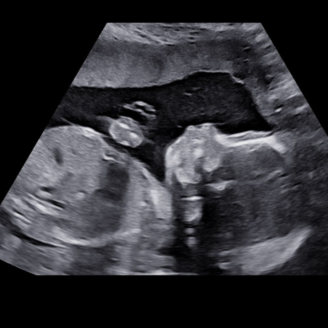 Photo shared by Sheyanne for their Babylist baby registry.