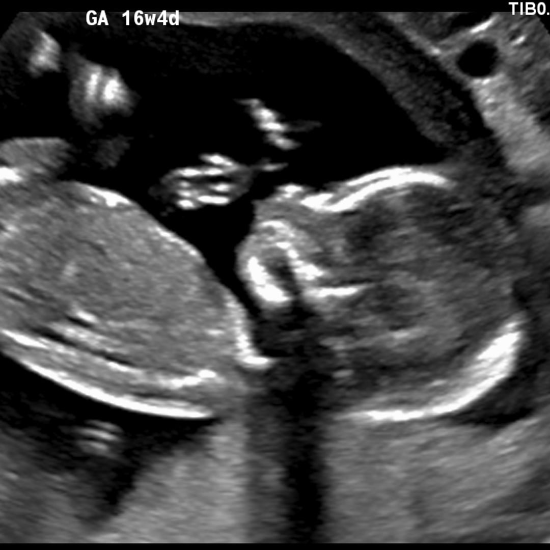 Photo shared by McKadee for their Babylist baby registry.