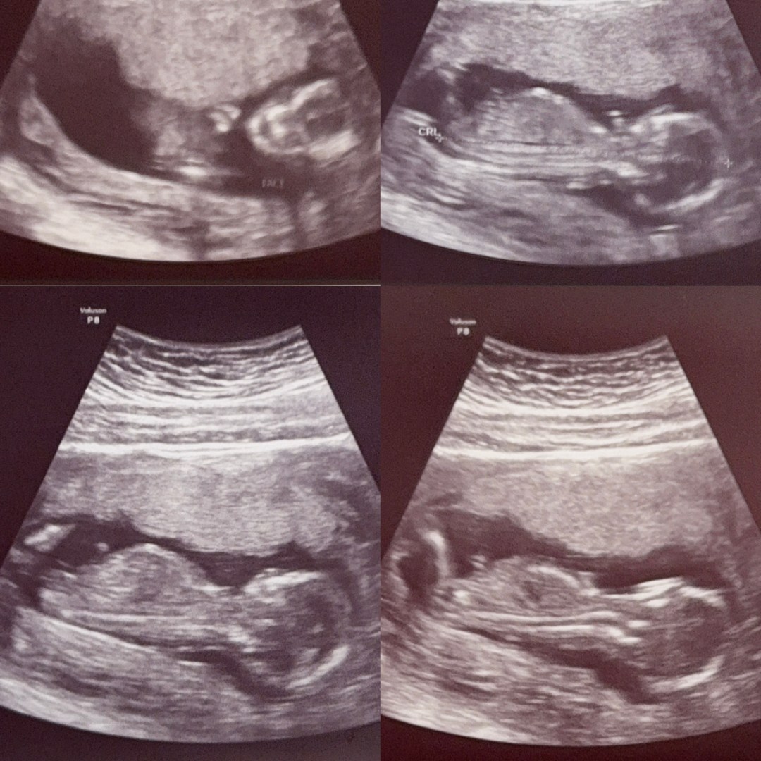 Photo shared by Angelynn for their Babylist baby registry.