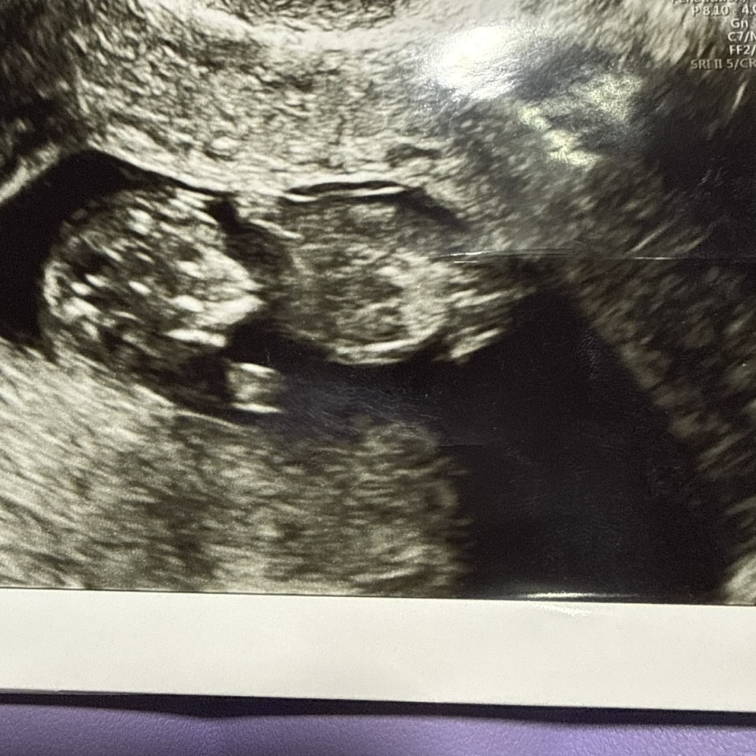 Photo shared by DeAnna for their Babylist baby registry.
