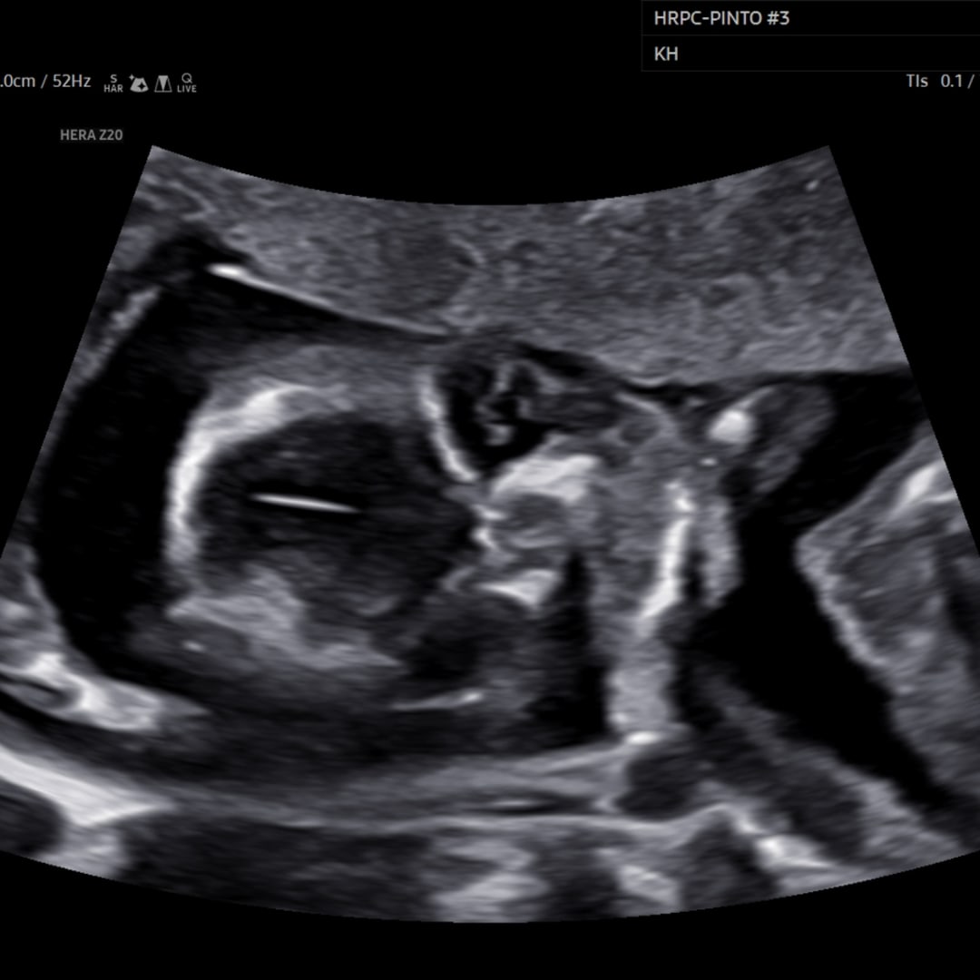 Photo shared by Arianna for their Babylist baby registry.