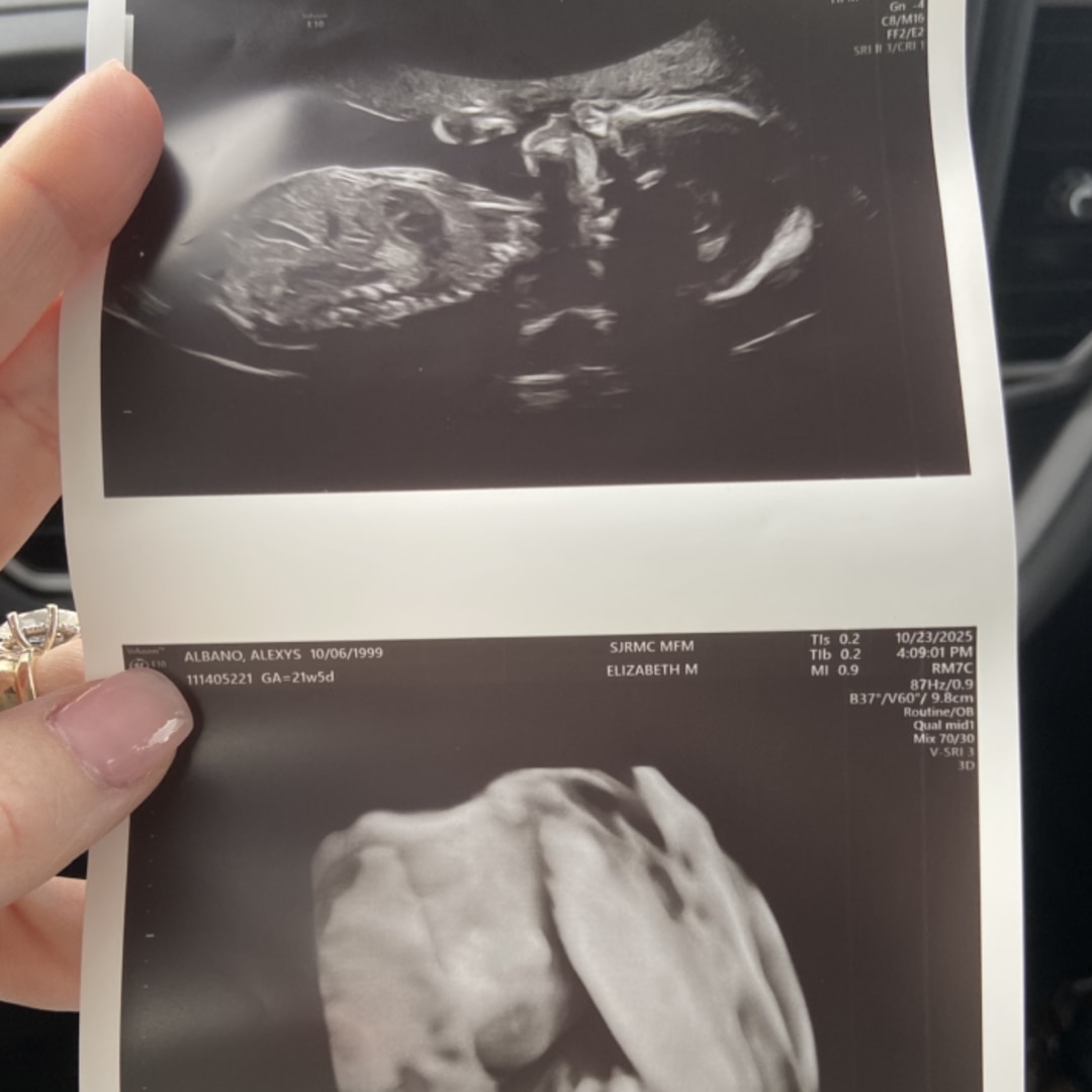 Photo shared by Lexy for their Babylist baby registry.