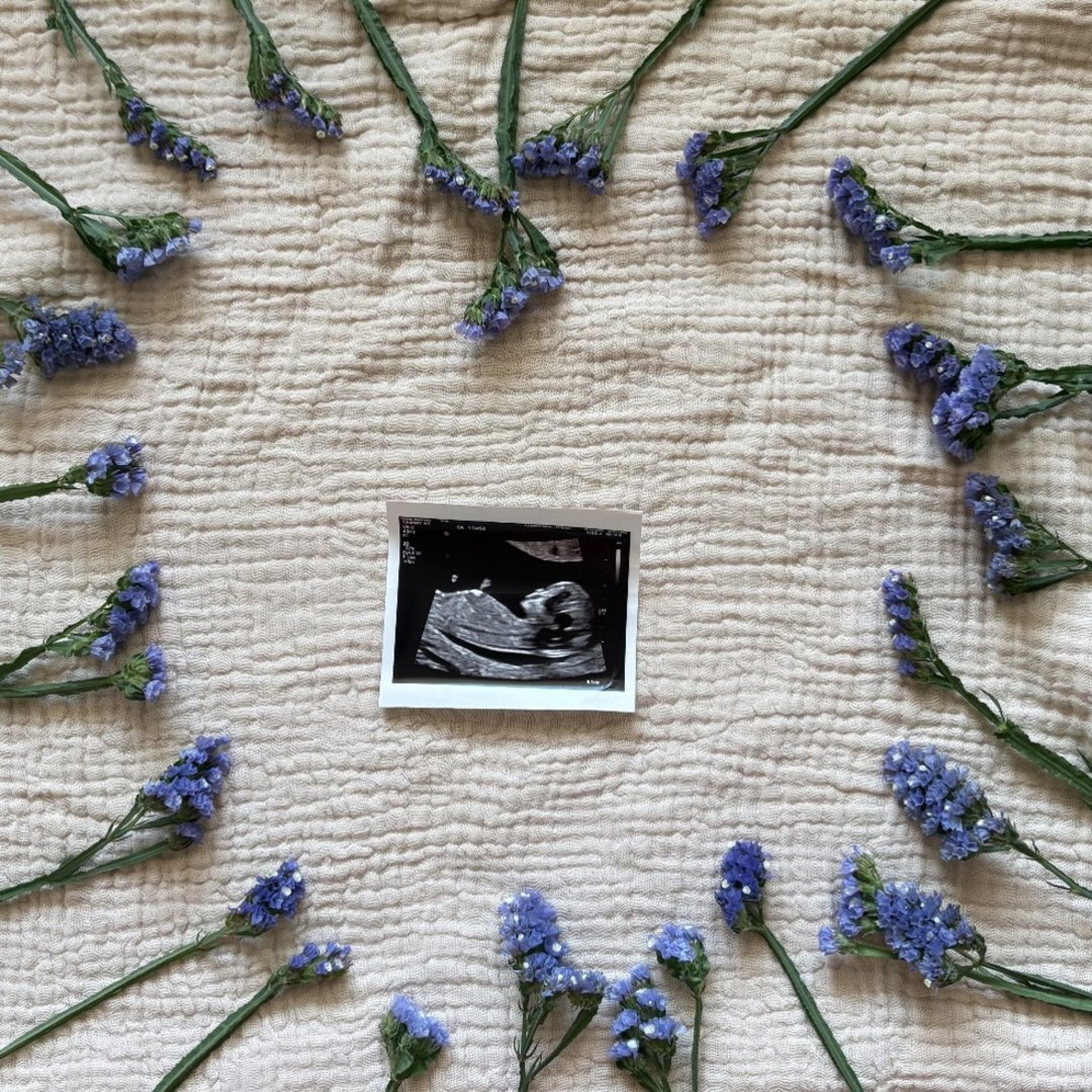 Photo shared by Rosemary for their Babylist baby registry.