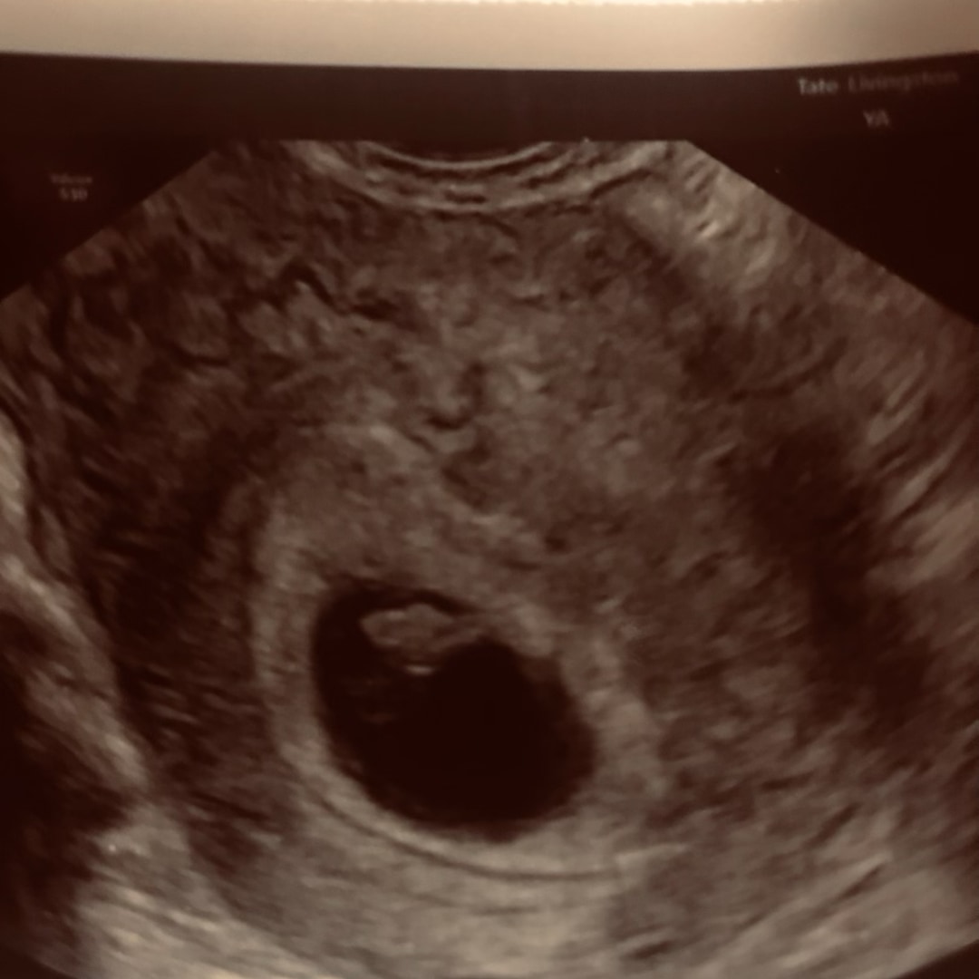 Photo shared by Yesenia for their Babylist baby registry.