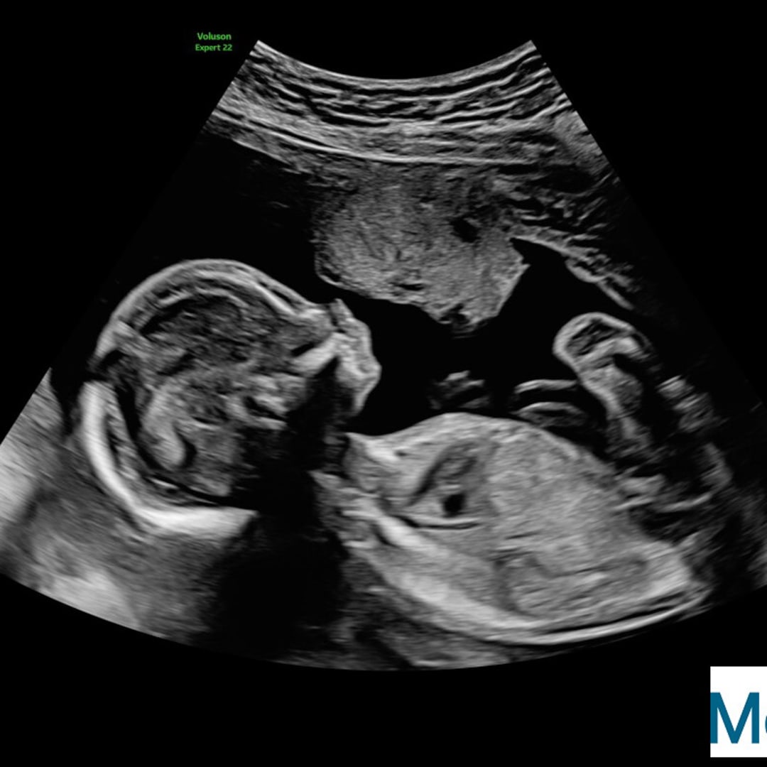 Photo shared by Jamie for their Babylist baby registry.