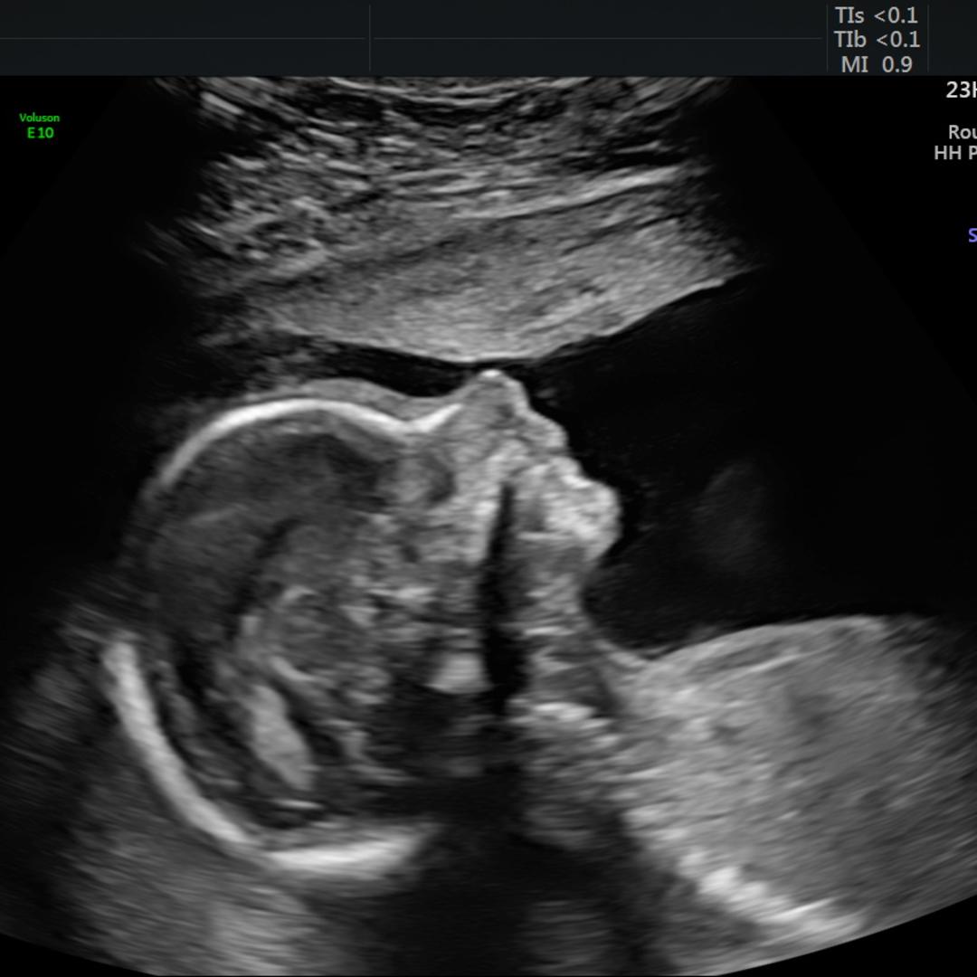 Photo shared by Katrina for their Babylist baby registry.