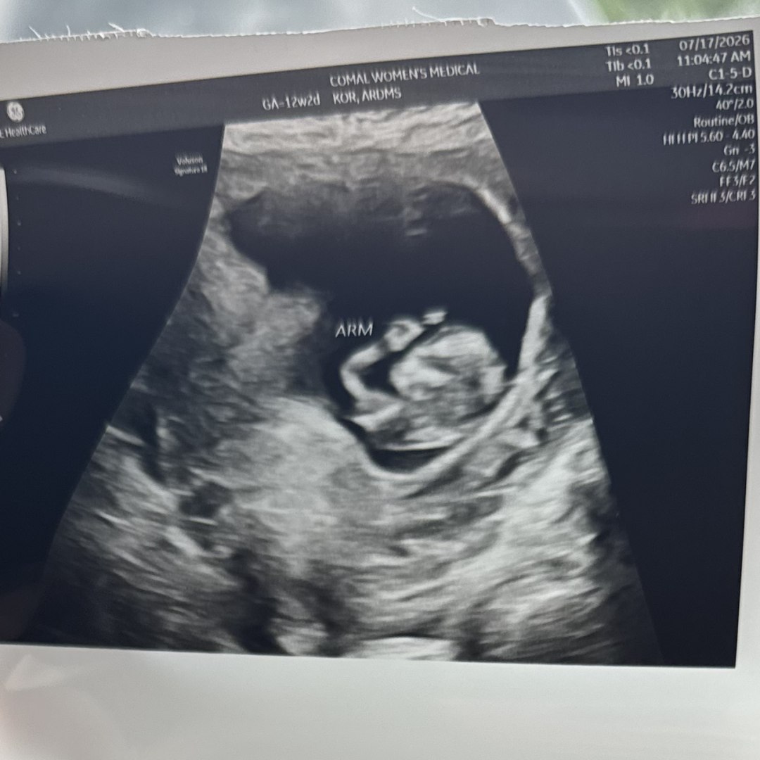 Photo shared by Hannah for their Babylist baby registry.