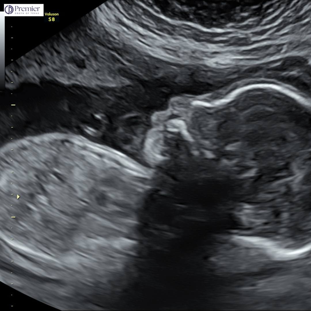 Photo shared by Vanessa for their Babylist baby registry.