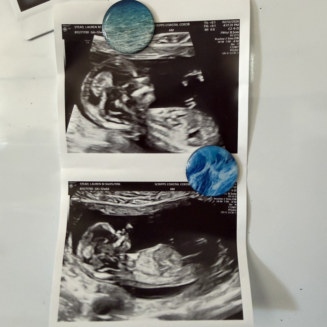 Photo shared by Lauren for their Babylist baby registry.