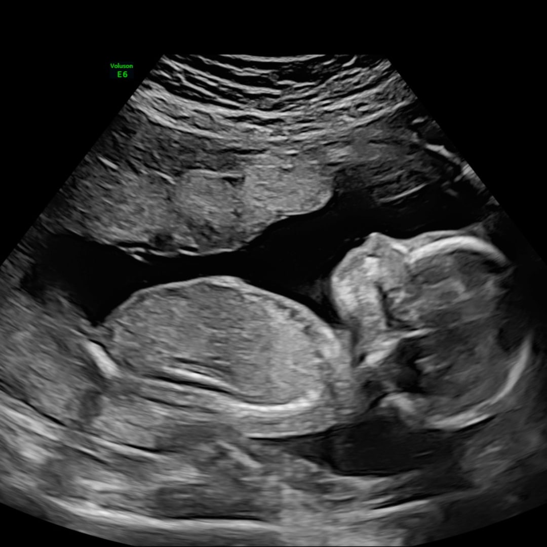 Photo shared by Alayne Dizon & Manuel for their Babylist baby registry.