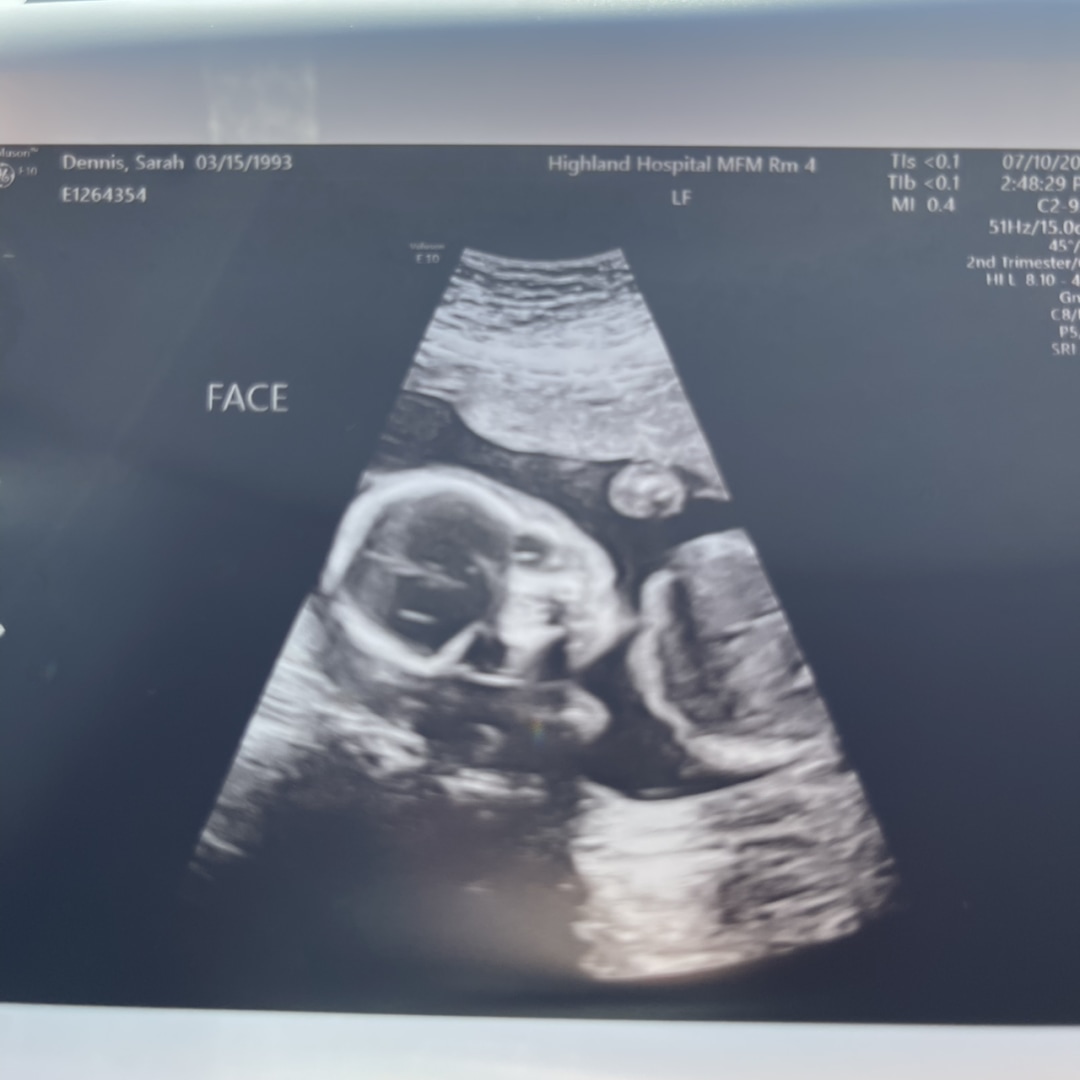 Photo shared by Sarah for their Babylist baby registry.