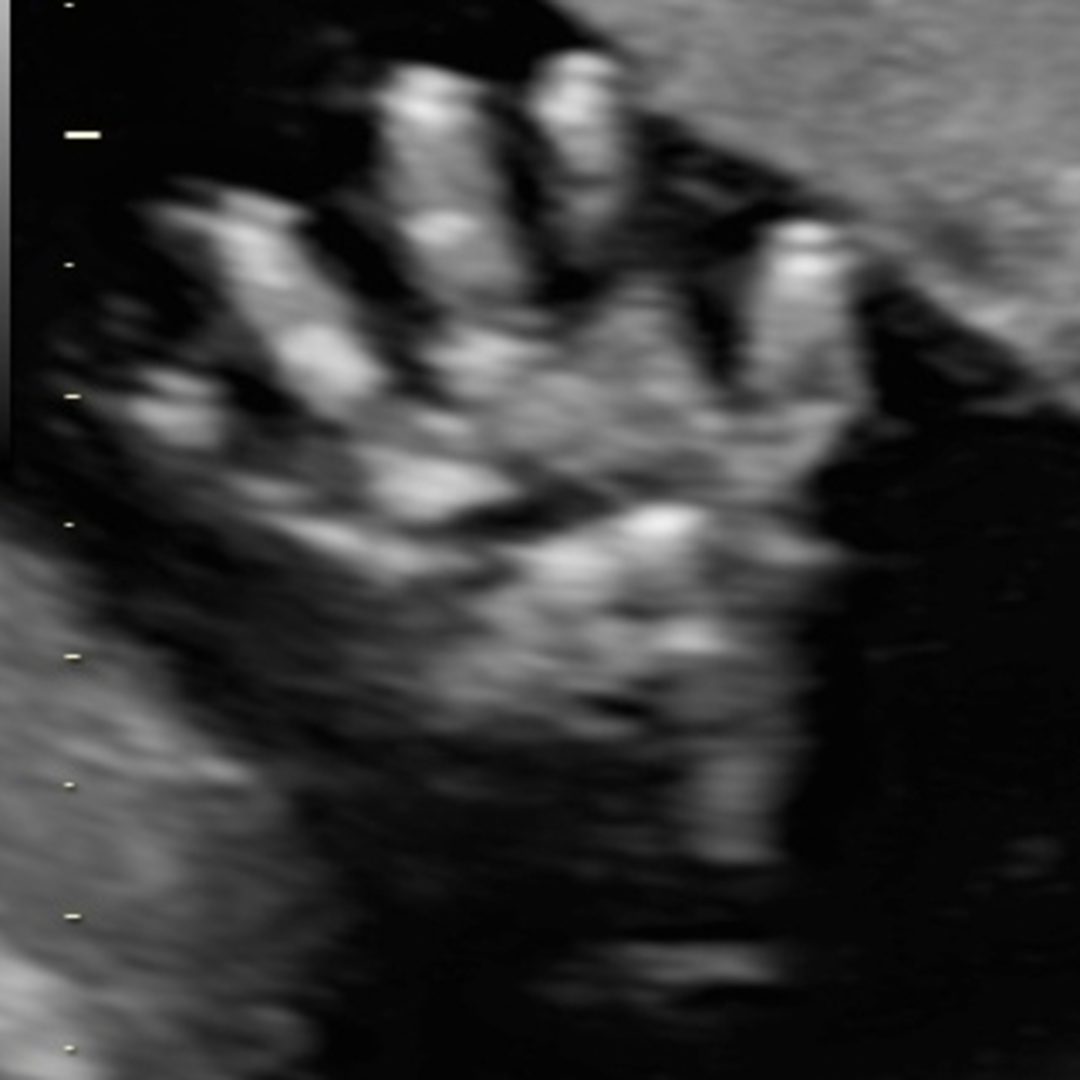 Photo shared by Jaimie for their Babylist baby registry.