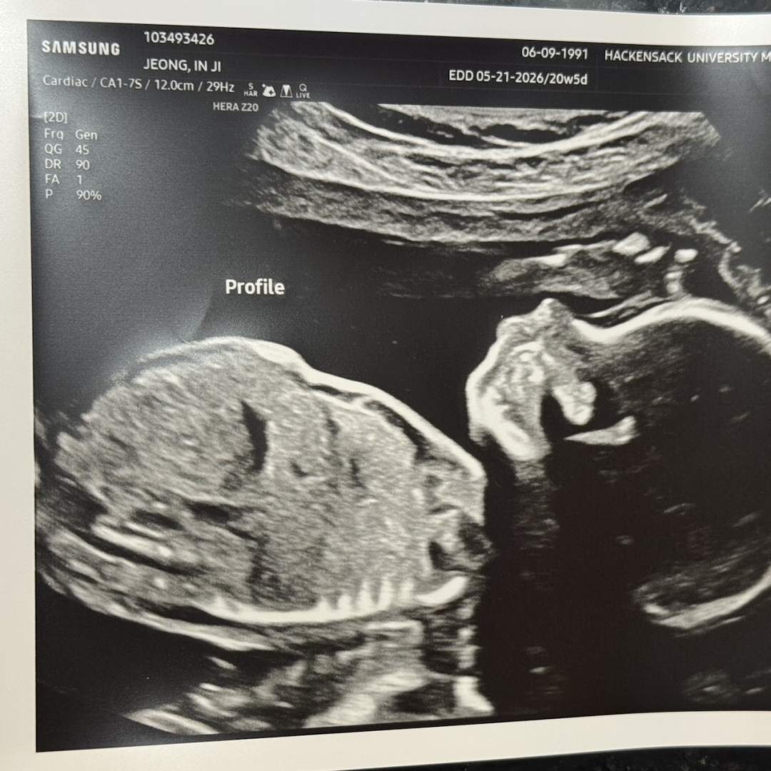 Photo shared by In Ji for their Babylist baby registry.