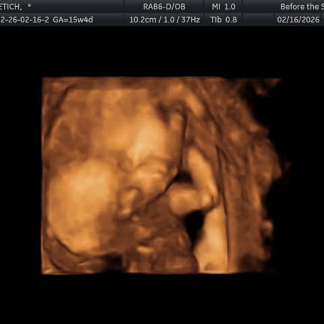 Photo shared by Alyssa for their Babylist baby registry.