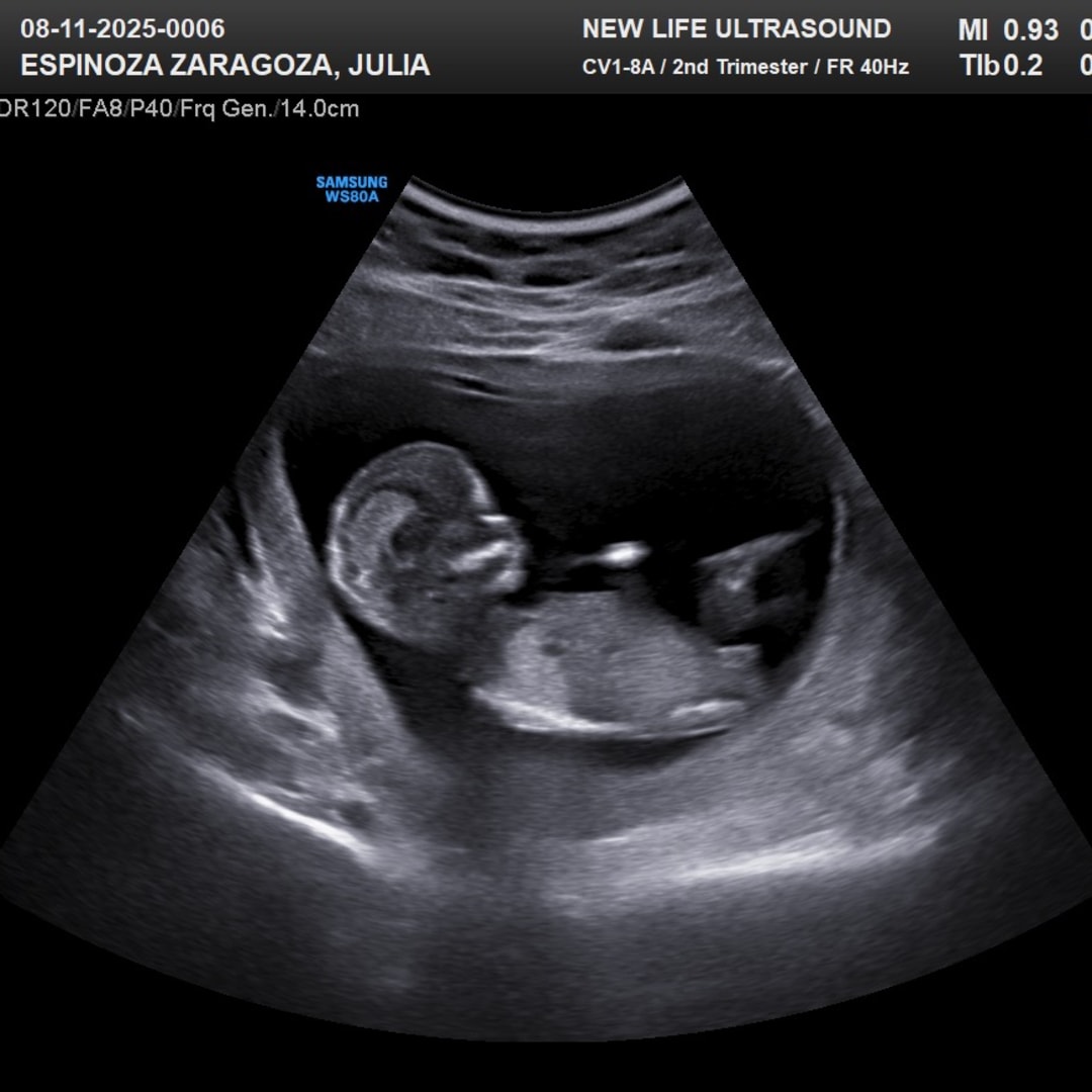 Photo shared by Julia for their Babylist baby registry.