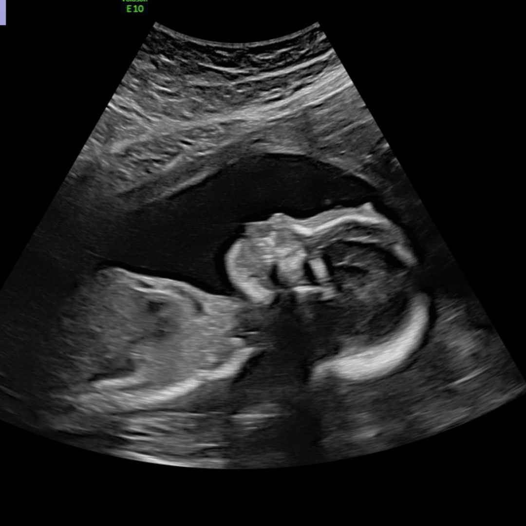 Photo shared by Faith for their Babylist baby registry.