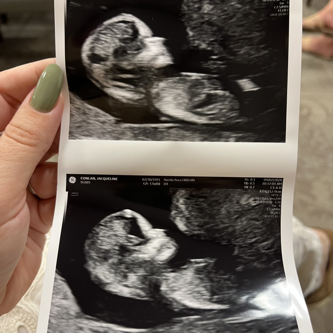 Photo shared by Jackie for their Babylist baby registry.