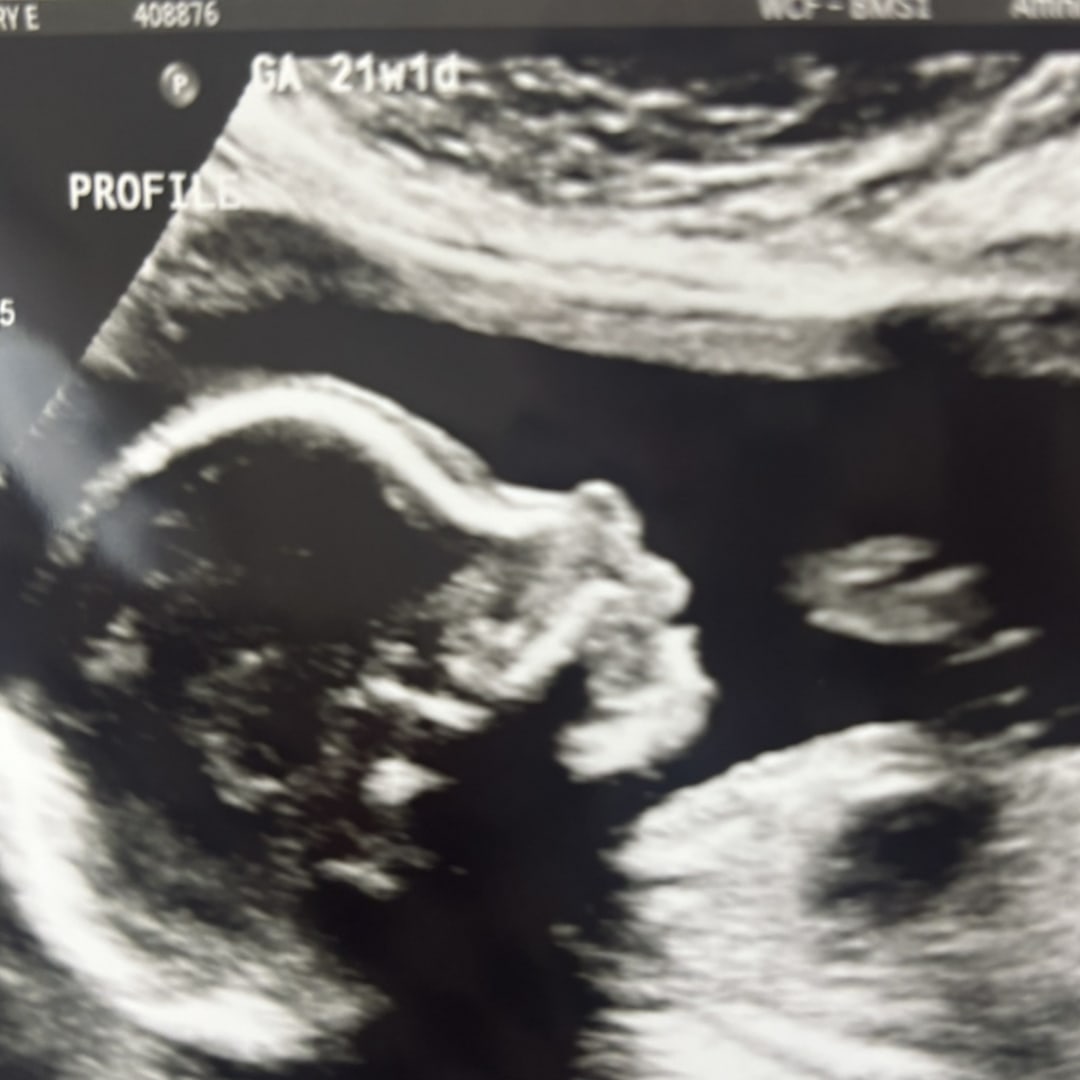 Photo shared by Avery for their Babylist baby registry.