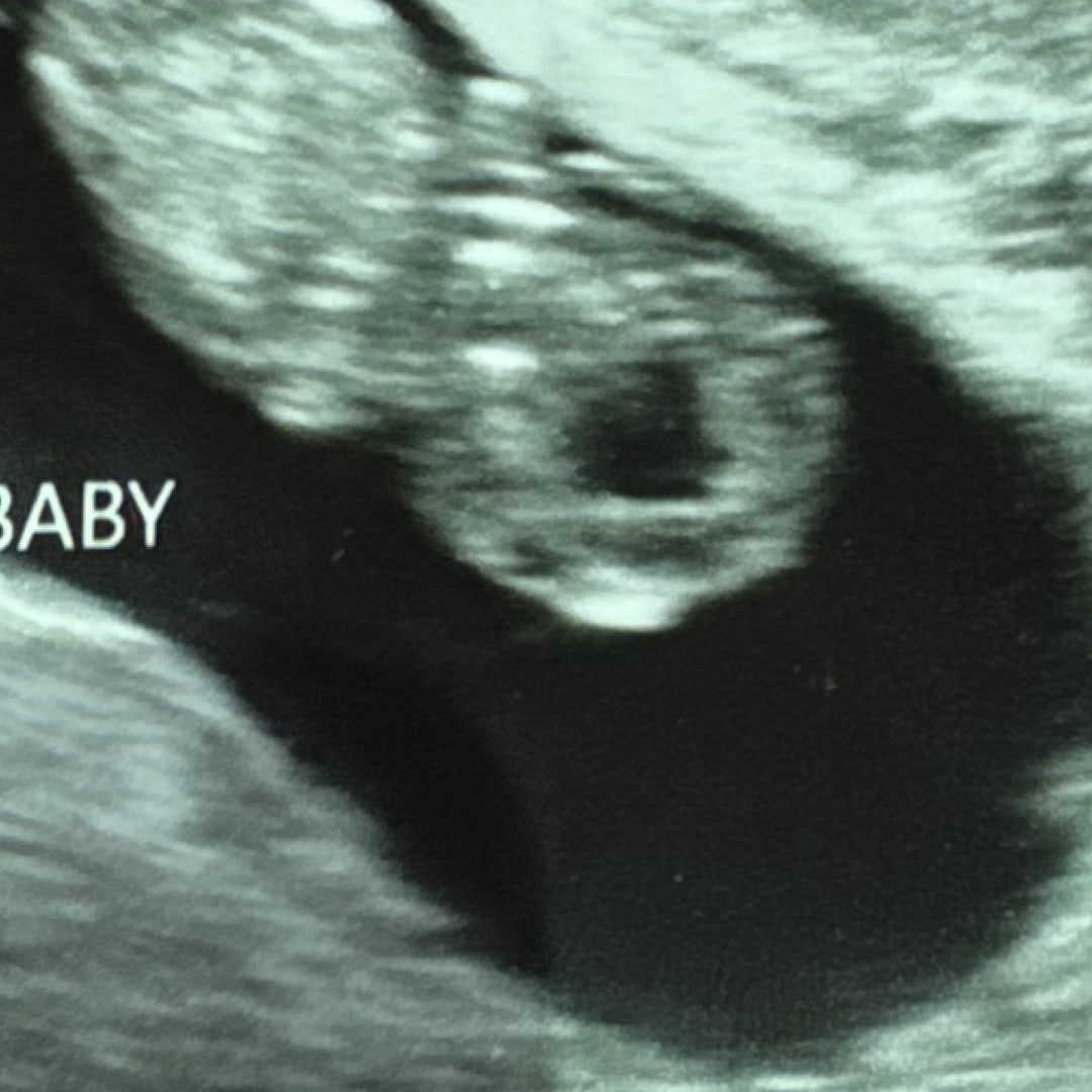 Photo shared by Amber for their Babylist baby registry.