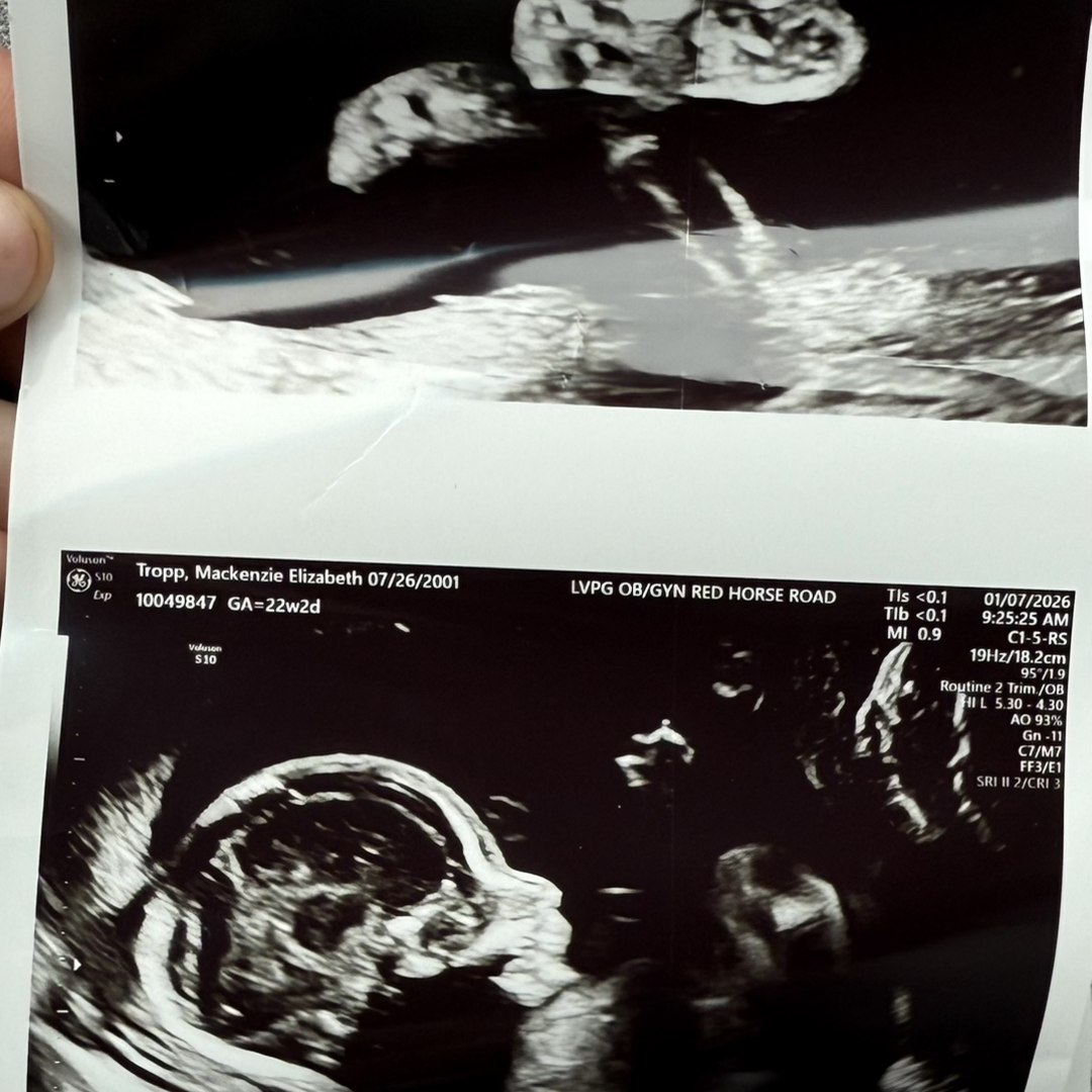 Photo shared by Mackenzie for their Babylist baby registry.