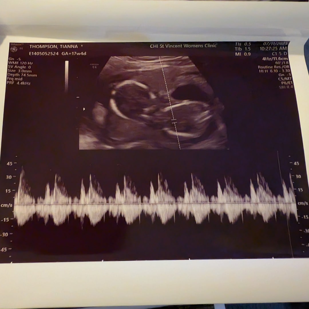 Photo shared by Tianna for their Babylist baby registry.