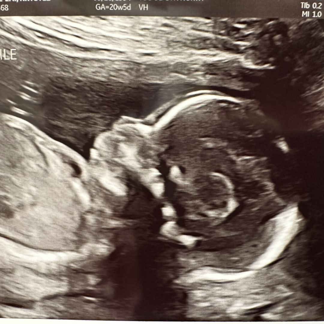 Photo shared by Krystle for their Babylist baby registry.