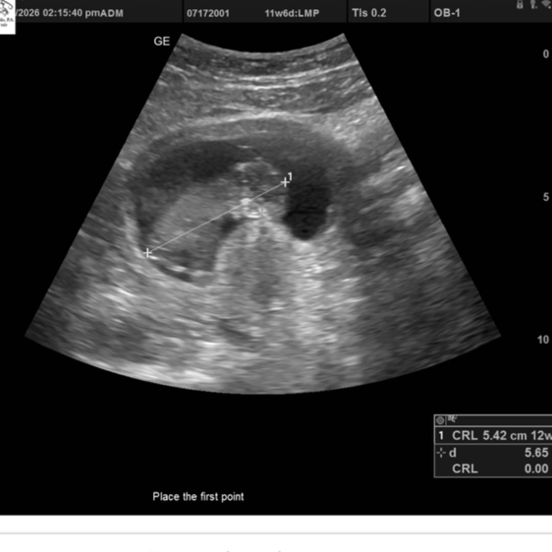 Photo shared by America for their Babylist baby registry.