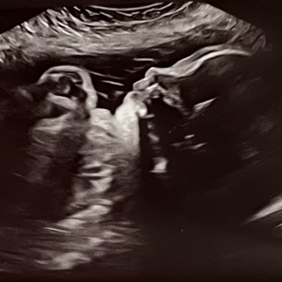 Photo shared by Kayla for their Babylist baby registry.