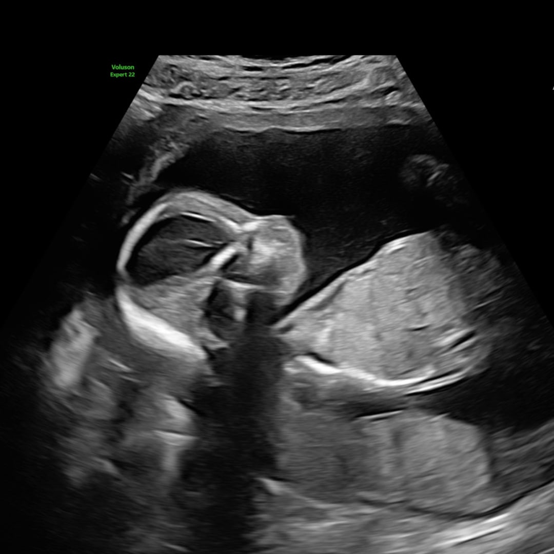 Photo shared by Courtney for their Babylist baby registry.
