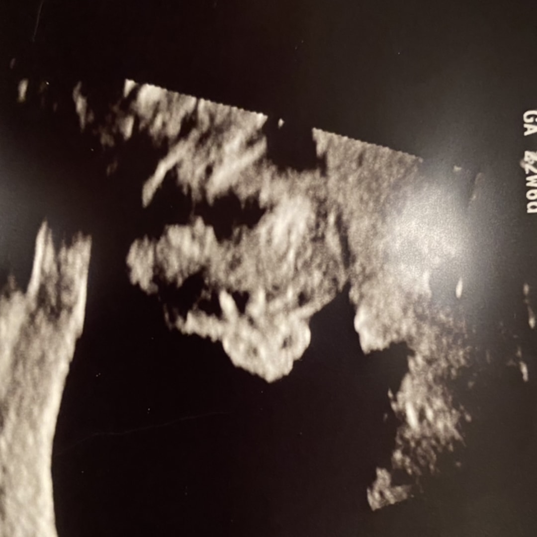 Photo shared by Simone for their Babylist baby registry.