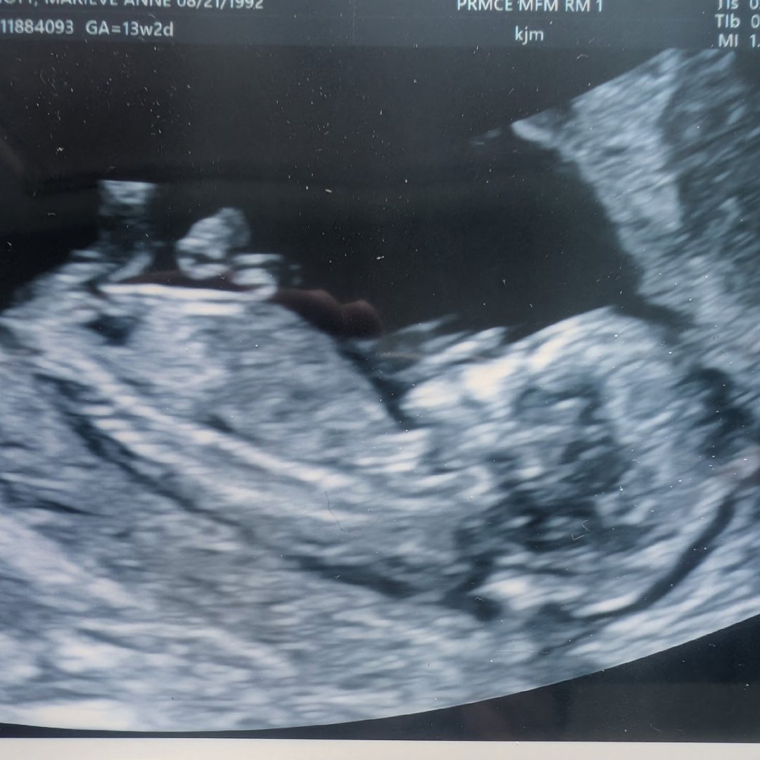 Photo shared by Marieve for their Babylist baby registry.