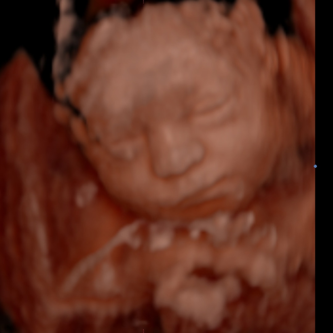 Photo shared by Abby for their Babylist baby registry.