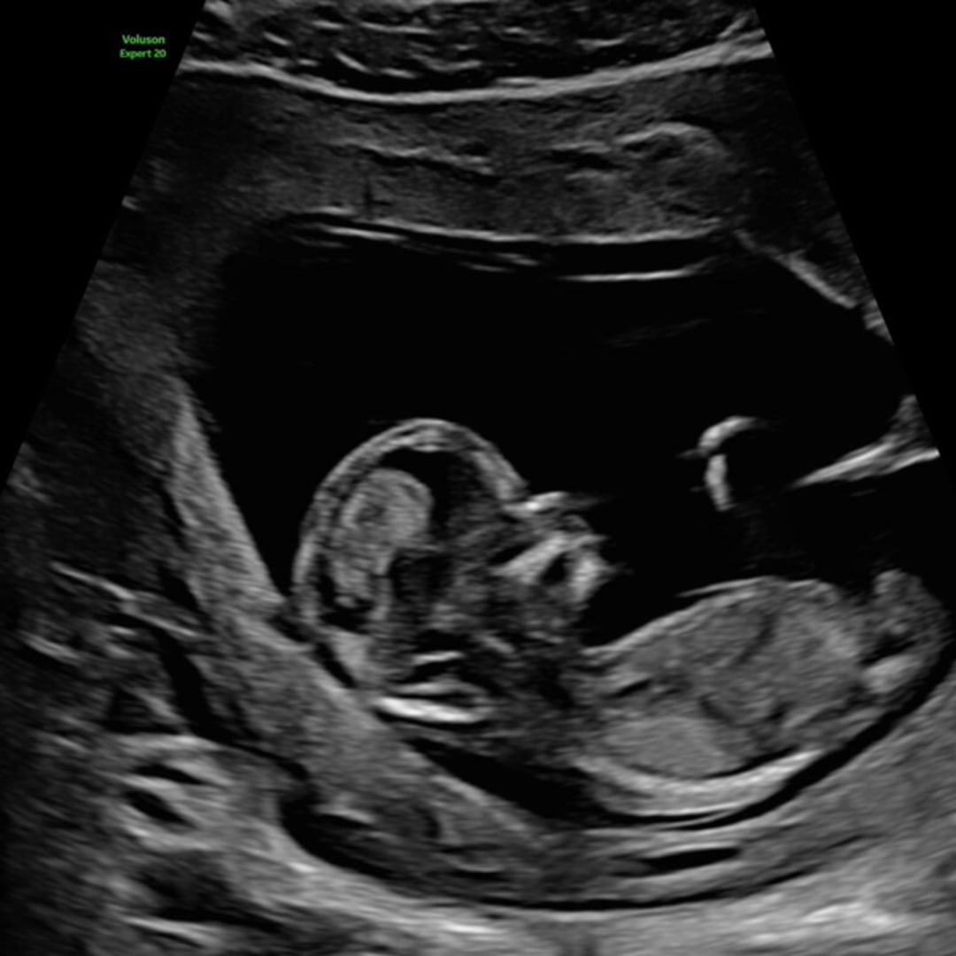 Photo shared by Meg for their Babylist baby registry.