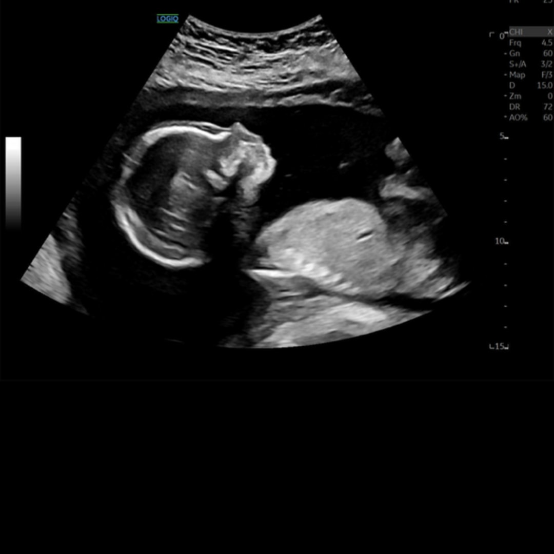Photo shared by Emily for their Babylist baby registry.