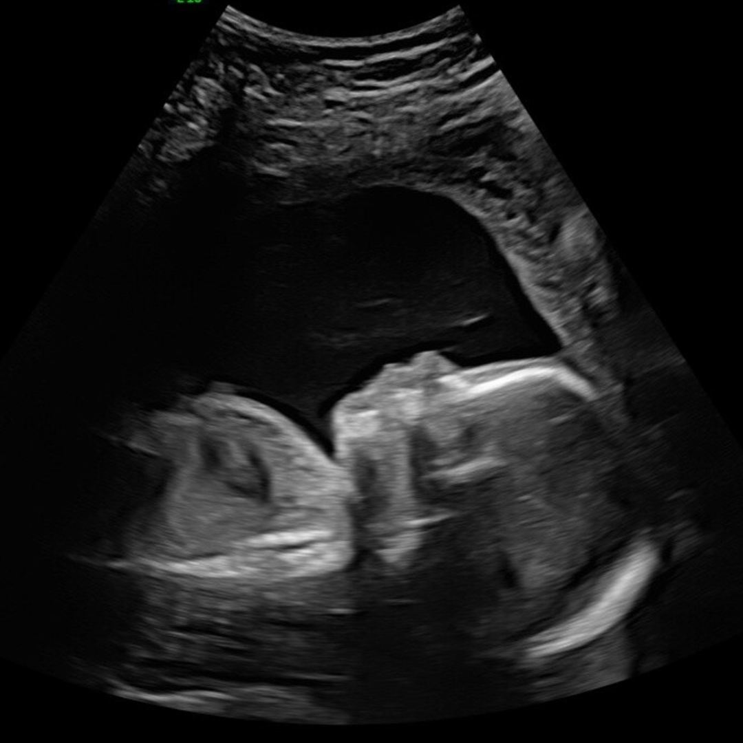 Photo shared by Micah for their Babylist baby registry.
