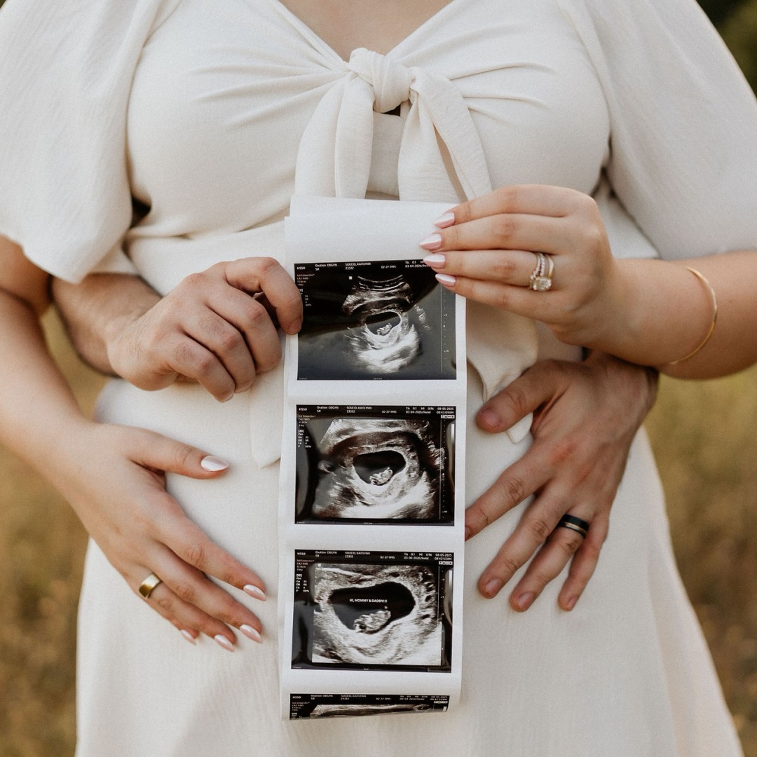 Photo shared by Kate for their Babylist baby registry.