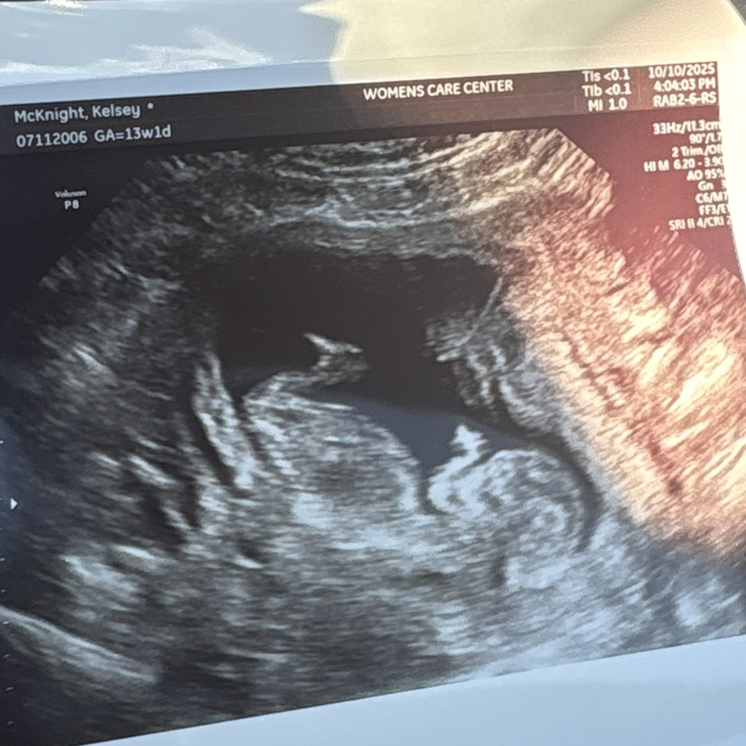 Photo shared by Kelsey for their Babylist baby registry.