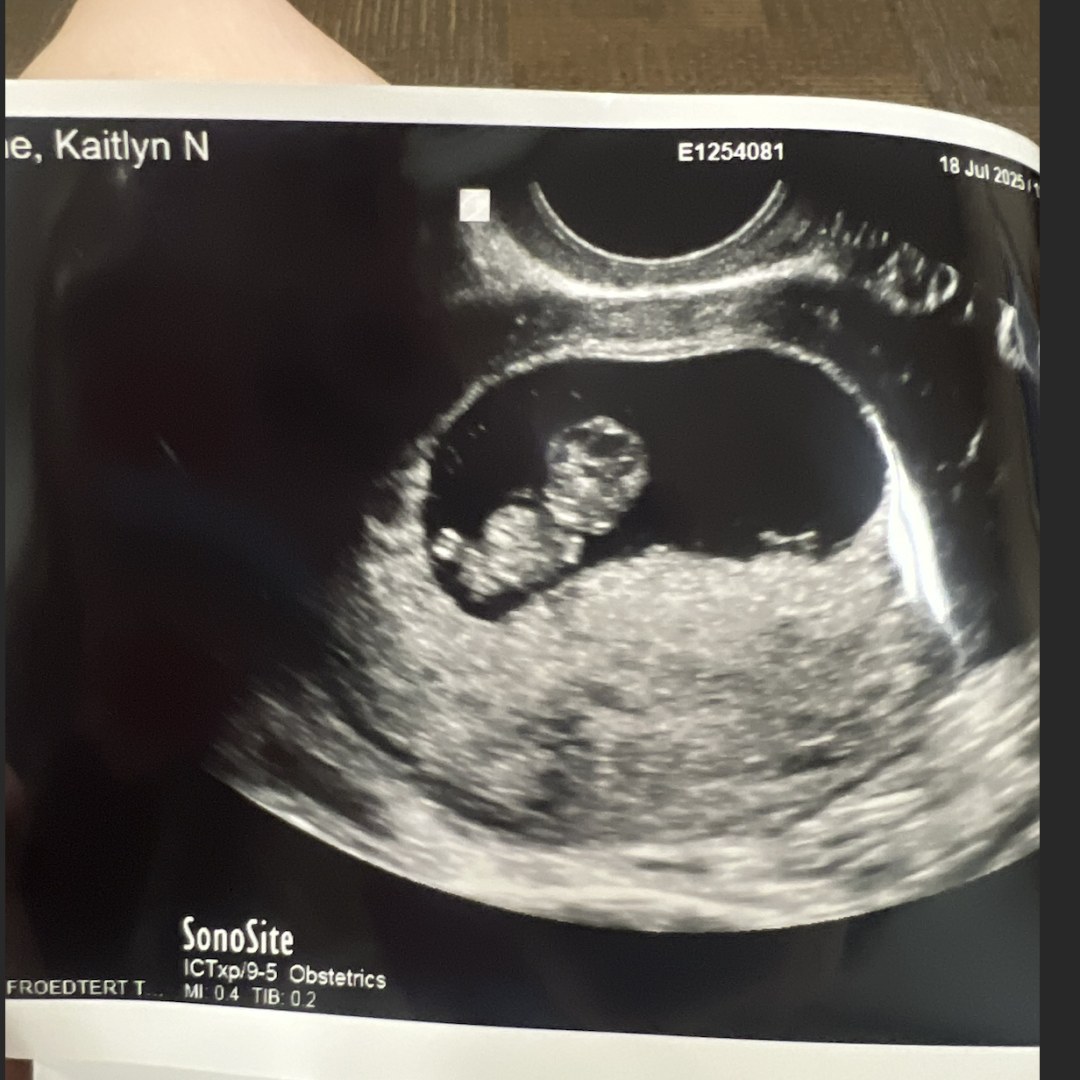 Photo shared by Katie for their Babylist baby registry.